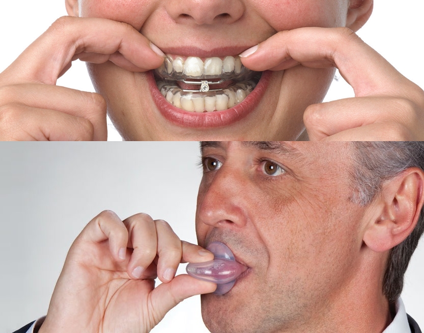 การใช้เครื่องมือทางช่องปาก (oral appliance)