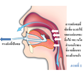 เครื่องทำให้เกิดความดันลบในช่องปาก (OPT) คืออะไร?